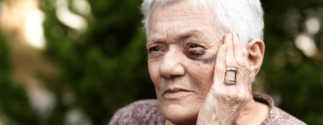 an older woman with a black eye